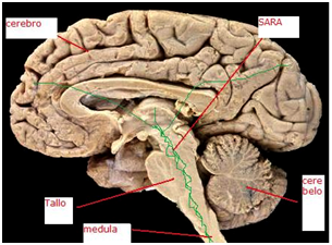 Figura 3. El SARA es una especie de red neuronal que ejerce una influencia excitadora en todo el cerebro